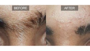 beforeafter1