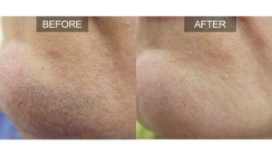 beforeafter2