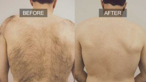 beforeafterback