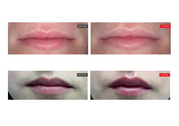 Before & After