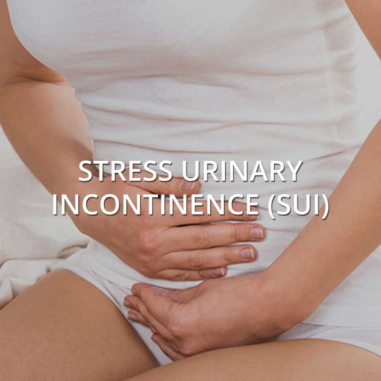Stress Urinary Incontinence