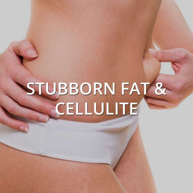 Unwanted Stubborn Fat & Cellulite