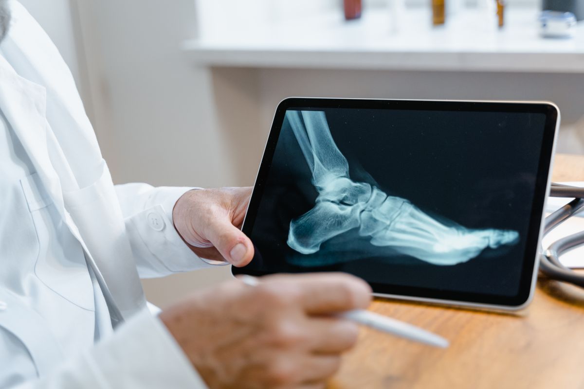 Clinician reviewing a foot X-ray for heel pain treatment in Vancouver